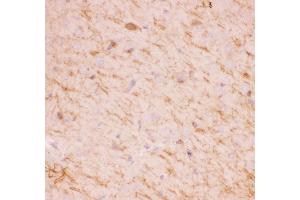 Anti-SIRT2 Picoband antibody,  IHC(P): Mouse Brain Tissue