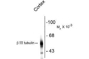 Western blots of rat cortex lysate showing specific immunolabeling of the ~55k beta III tubulin protein. (TUBB3 anticorps)