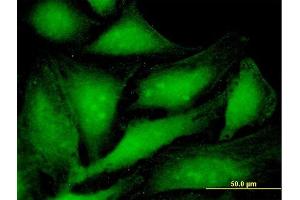 Immunofluorescence of purified MaxPab antibody to PSME1 on HeLa cell.