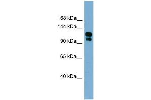 WB Suggested Anti-TRPA1 Antibody Titration:  0. (TRPA1 anticorps  (Middle Region))