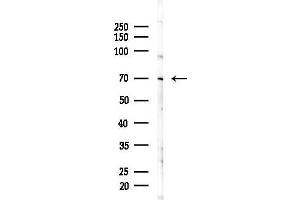 anti-Kinesin Family Member C1 (KIFC1) (Internal Region) antibody