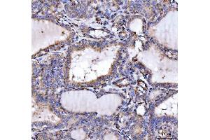 IHC analysis of SLU7 using anti-SLU7 antibody (ABIN7601697). (SLU7 anticorps  (AA 42-474))