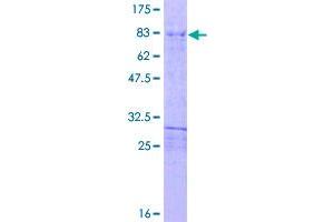 Image no. 1 for Homeobox D3 (HOXD3) (AA 1-432) protein (GST tag) (ABIN1307007)