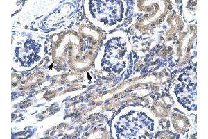TRAFD1 antibody was used for immunohistochemistry at a concentration of 4-8 ug/ml to stain Epithelial cells of renal tubule (lndicated with Arrows] in Human Kidney. (TRAFD1 anticorps  (C-Term))