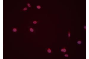 ABIN6274008 staining Hela cells by IF/ICC. (DUSP6 anticorps  (Internal Region))