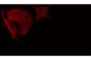 ABIN6274835 staining HeLa cells by IF/ICC. (SGCA anticorps  (Internal Region))