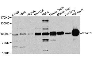 Western blot analysis of extracts of various cell lines, using STAT3 antibody.