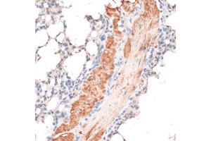 Immunohistochemistry of paraffin-embedded mouse lung using ABCB7 antibody. (ABCB7 anticorps)