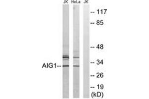 Western Blotting (WB) image for anti-Androgen-Induced 1 (AIG1) (AA 196-245) antibody (ABIN2890118) (AIG1 anticorps  (AA 196-245))