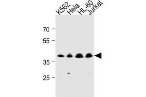 Western Blotting (WB) image for anti-Mitochondrial Trans-2-Enoyl-CoA Reductase (MECR) antibody (ABIN3004507) (MECR anticorps)
