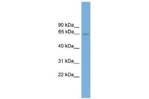 CARD9 antibody used at 0. (CARD9 anticorps  (Middle Region))