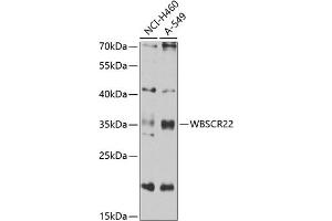 Western blot analysis of extracts of various cell lines, using WBSCR22 antibody (ABIN6132946, ABIN6150175, ABIN6150176 and ABIN6223157) at 1:1000 dilution. (WBSCR22 anticorps  (AA 1-281))