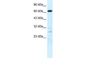 WB Suggested Anti-CRSP6 Antibody Titration:  0. (MED17 anticorps  (N-Term))