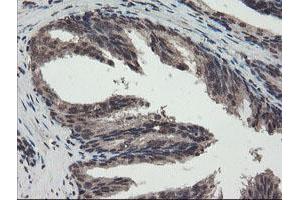 Image no. 6 for anti-Tryptophan 2,3-Dioxygenase (TDO2) antibody (ABIN1501352)