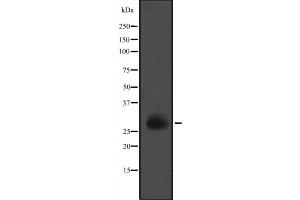 Western blot analysis of GZMM expression in K562 cell line lysates ;,The lane on the left is treated with the antigen-specific peptide. (GZMM anticorps  (Internal Region))