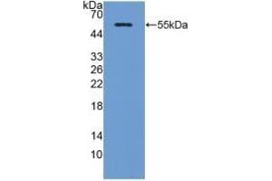 Detection of Recombinant ADP, Porcine using Polyclonal Antibody to Adiponectin (ADPN) (ADIPOQ anticorps  (AA 17-243))