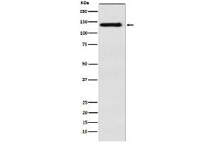 Western blot analysis of Integrin alpha 9 expression in HepG2 cell lysate.