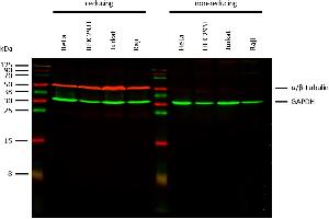 anti-Alpha, beta-Tubulin Dimer antibody