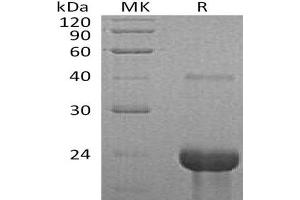 Western Blotting (WB) image for Tumor Necrosis Factor Receptor Superfamily, Member 1A (TNFRSF1A) protein (ABIN7320716) (TNFRSF1A Protéine)