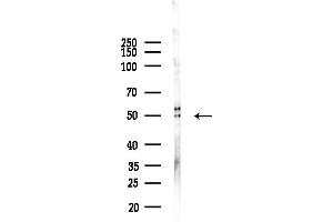 Western blot analysis of lysates from Hela cells(LPS, 4h treatment), using Phospho-Lyn (Tyr508) Antibody at 1/1000 dilution.