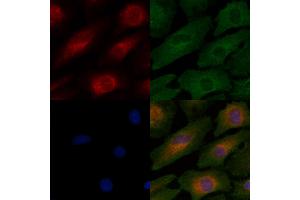 ABIN6259928 and ABIN6276407 staining  cells by IF/ICC.