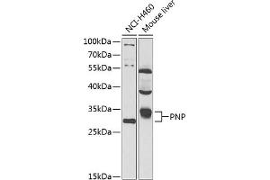 Western blot analysis of extracts of various cell lines, using PNP antibody  at 1:1000 dilution. (PNP anticorps  (AA 1-289))