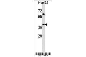 Western Blotting (WB) image for Mouse anti-Human IgG1 (AA 154-180) antibody (ABIN1498832)