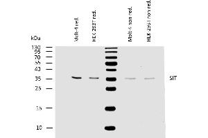 Western blotting analysis of human SIT using mouse monoclonal antibody SIT-01 on lysates of Molt-4 and HEK-293T cells under reducing and non-reducing conditions.