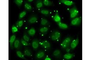 Immunofluorescence analysis of MCF7 cells using DR1 Polyclonal Antibody (DR1 anticorps)