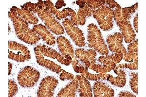 Formalin-fixed, paraffin-embedded human stomach stained with MUC5AC antibody (MUC5AC/917 + 45M1).