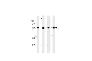TPIPb Antibody (C-term) ABIN1882284 western blot analysis in 293,A431,,mouse NIH/3T3 cell line lysates (35 μg/lane). (TPTE2 anticorps)