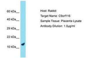 Image no. 1 for anti-Chromosome 9 Open Reading Frame 116 (C9ORF116) (AA 39-88) antibody (ABIN6750756) (C9ORF116 anticorps  (AA 39-88))