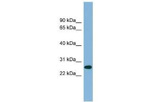 SRRP35 antibody used at 1 ug/ml to detect target protein. (SRSF12 anticorps  (Middle Region))