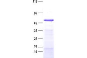 Validation with Western Blot (IP6K3 Protein (His tag))