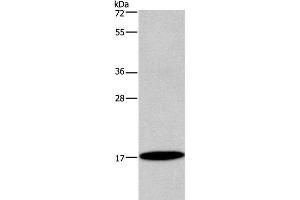 Western Blot analysis of Mouse bladder tissue using ID4 Polyclonal Antibody at dilution of 1:300 (ID4 anticorps)