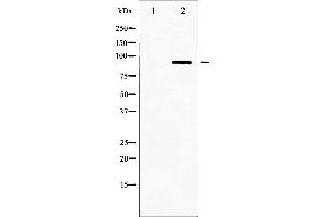 Western blot analysis of IKK alpha/ beta phosphorylation expression in TNF treated HepG2 whole cell lysates,The lane on the left is treated with the antigen-specific peptide.