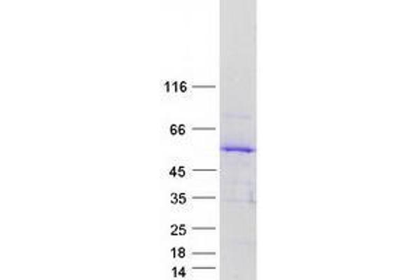 TSPYL5 Protein (Myc-DYKDDDDK Tag)