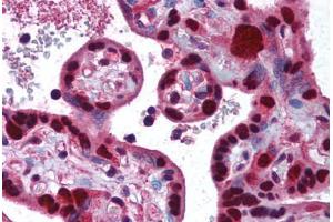 Human Placenta (formalin-fixed, paraffin-embedded) stained with DNMT1 antibody ABIN290479 at 2. (DNMT1 anticorps  (AA 177-550))