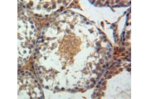 IHC-P analysis of Testis tissue, with DAB staining. (Paxillin anticorps  (AA 347-578))
