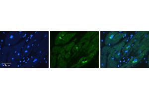 Rabbit Anti-KAT5 Antibody Catalog Number: ARP38792_P050 Formalin Fixed Paraffin Embedded Tissue: Human heart Tissue Observed Staining: Cytoplasmic Primary Antibody Concentration: 1:100 Other Working Concentrations: 1:600 Secondary Antibody: Donkey anti-Rabbit-Cy3 Secondary Antibody Concentration: 1:200 Magnification: 20X Exposure Time: 0. (KAT5 anticorps  (C-Term))