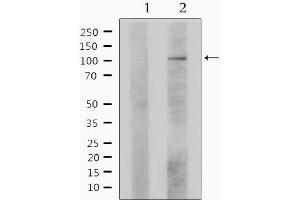 Western blot analysis of extracts from Hela, using LIG4 Antibody.