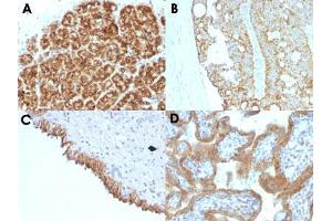Immunohistochemical staining (Formalin-fixed paraffin-embedded sections) of human pancreas (A), human colon carcinoma (B), human bladder carcinoma (C) and human placenta (D) with MAML2 monoclonal antibody, clone MAML2/1302 . (MAML2 anticorps)