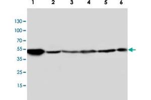 Western blot analysis of tissue and whole cell extracts with HTR2A polyclonal antibody . (HTR2A anticorps  (C-Term))