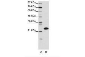 Image no. 1 for anti-TATA Box Binding Protein Associated Factor 11 (TAF11) (N-Term) antibody (ABIN6736151) (TAF11 anticorps  (N-Term))