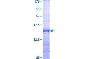 Image no. 1 for Signal-Induced Proliferation-Associated 1 (SIPA1) (AA 933-1042) protein (GST tag) (ABIN1320027)