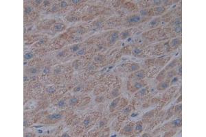 IHC-P analysis of liver tissue, with DAB staining. (ACADL anticorps  (Lys430))
