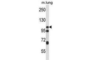 CTNND2 Antibody (C-term) western blot analysis in mouse lung tissue lysates (35µg/lane). (CTNND2 anticorps  (C-Term))