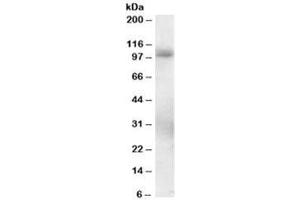 Western blot testing of human lung lysate with PDE5 antibody at 0. (PDE5A anticorps)