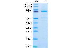P-Cadherin Protein (CDH3) (AA 108-654) (His tag)