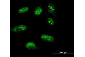 Image no. 1 for anti-LIM Homeobox 1 (LHX1) (AA 1-101) antibody (ABIN598782) (LHX1 anticorps  (AA 1-101))